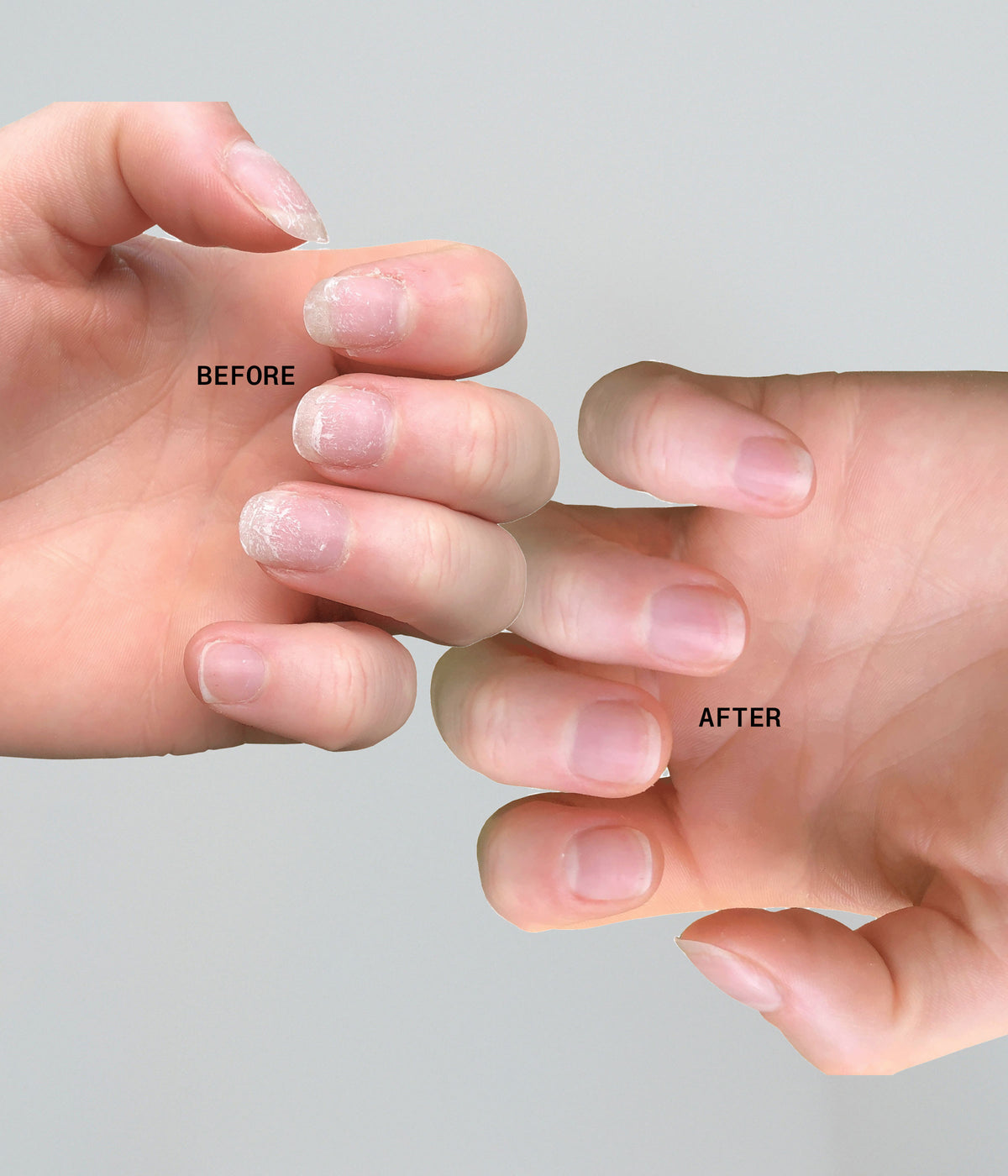 Ultimate Nail Rescue