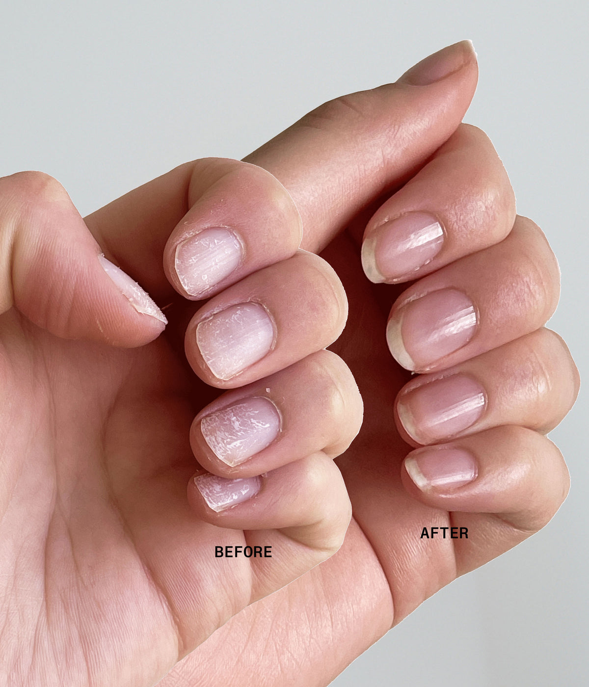 Ultimate Nail Rescue