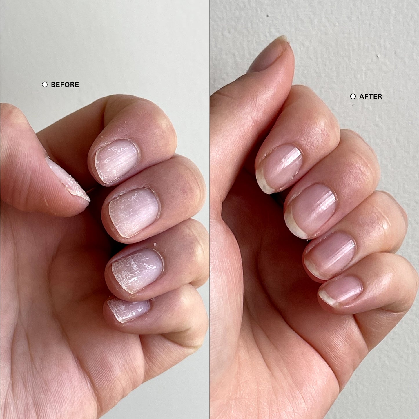Ultimate Nail Rescue