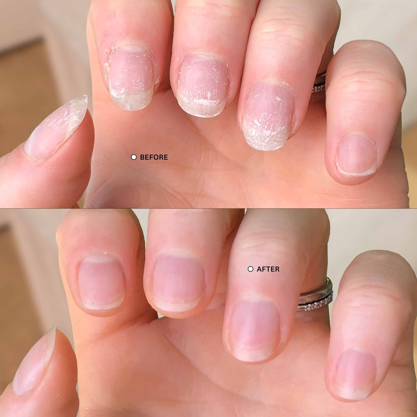 Ultimate Nail Rescue